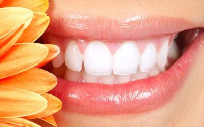 What are the details of keeping the teeth whitening it in our daily life