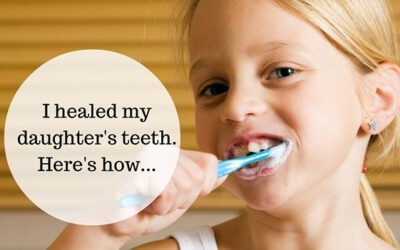 Caries Prevention and Self Care 