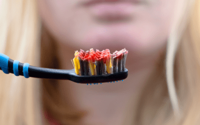 What Are The Common Bleeding In Gums Causes?