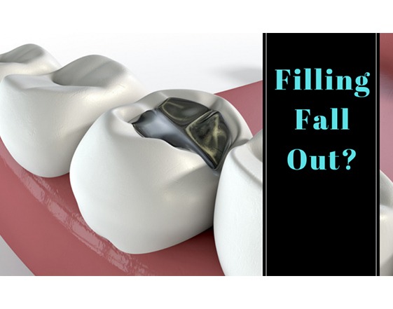 What do you do if a filling falls out of your tooth?